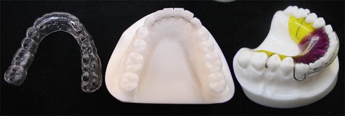 Types of orthodontic Retainers