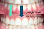 درمان نامرتبی و Cl II یک طرفه با کشیدن یک دندان در ۱۰ ماه