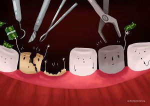 دندان خراب و هزینه درمان