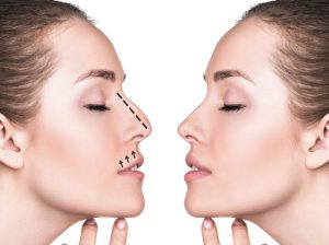 جراحی بینی و ارتودنسی