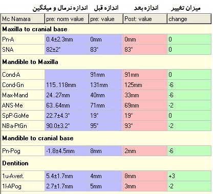 نتیجه پیش بینی اولیه جراحی زیبایی فک